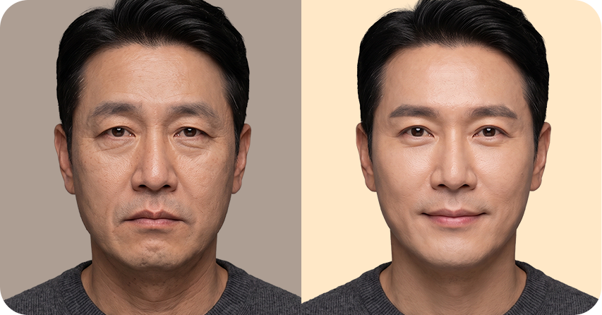 비포 애프터 3